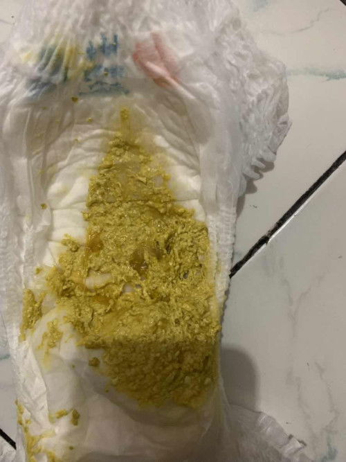 Pup bayi 5bulan bertekstur