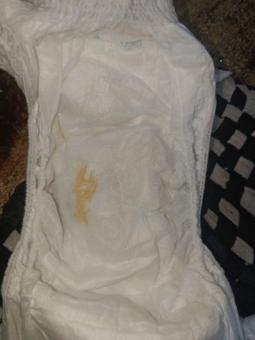 Pampers ada bercak orange