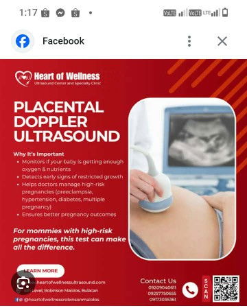 Need Po ba tlaga mag BPS w/ Placental Doppler grabe mahal 2500 tpos hirap pa hanapin