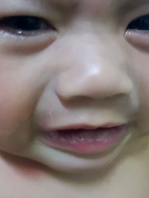 putih² dekat mulut baby 5bulan