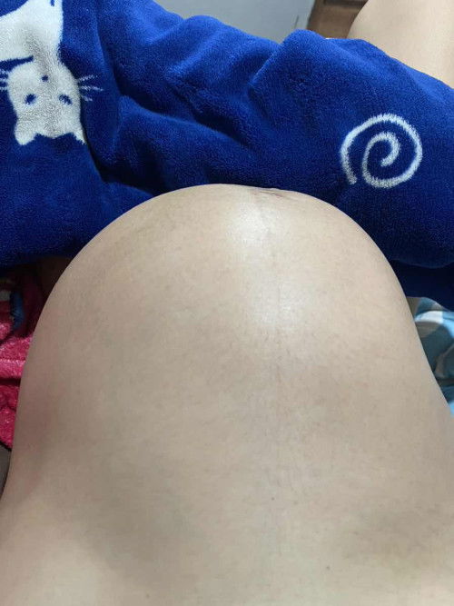 36w1d แบบนี้น้องโกงตัวหรือท้องแข็งคะ