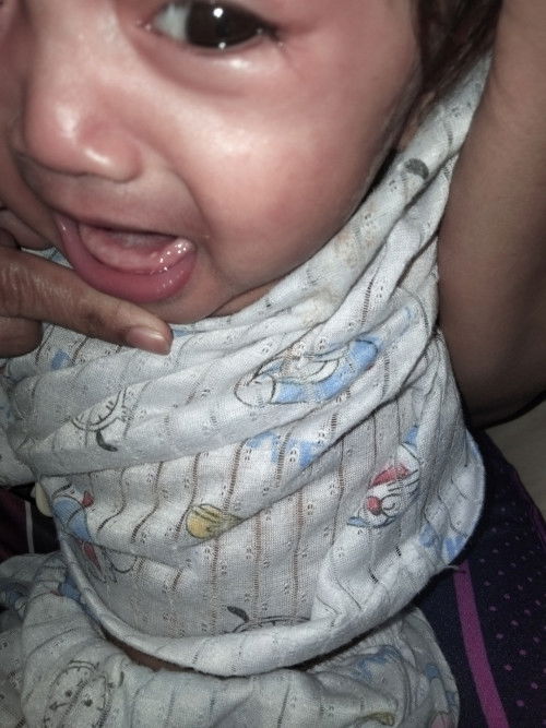 Assalamualaikum saya nak bertanya ada siapa2 tahu tak benda ni apa ya ada dalam mulut anak saya