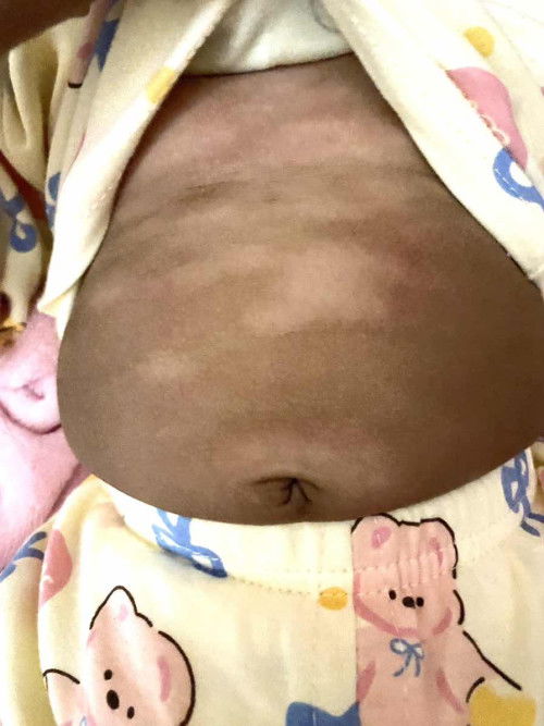 ด่างขาววงๆสากๆแบบนี้เรียกว่าอะไรคะ