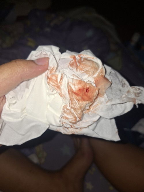 อายุครรภ์38+6