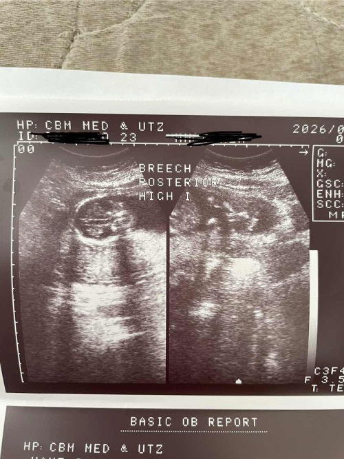 Gender at 17weeks