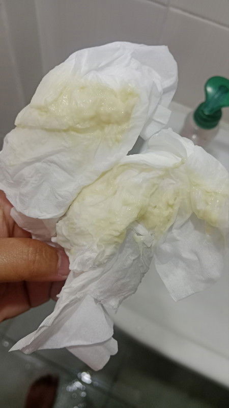 KEPUTIHAN BERLEBIHAN