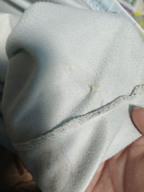 ปกติไหม ไม่แสบไม่คันไม่มีกลิ่น