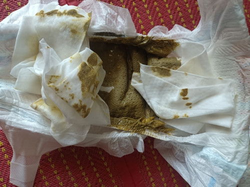 สีอึลูก ลูกอึเป็นสีเขียวขี้ม้า เหลว 
ถือว่าปกติมั้ยคะ ต้องไปหาหมอมั้ย น้องร่าเริง ทานนมปกติ