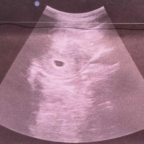 ขอสอบถามแม่ๆหน่อยค่ะ