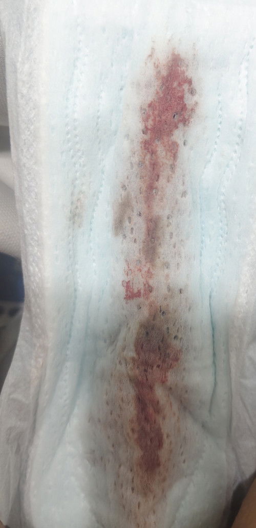 แบบนี้คือเลือดล้างหน้าเด็กไหม