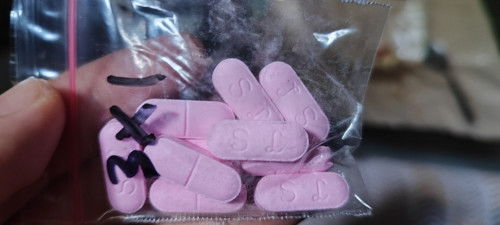 Kontraksi di usia kandungan 33 minggu