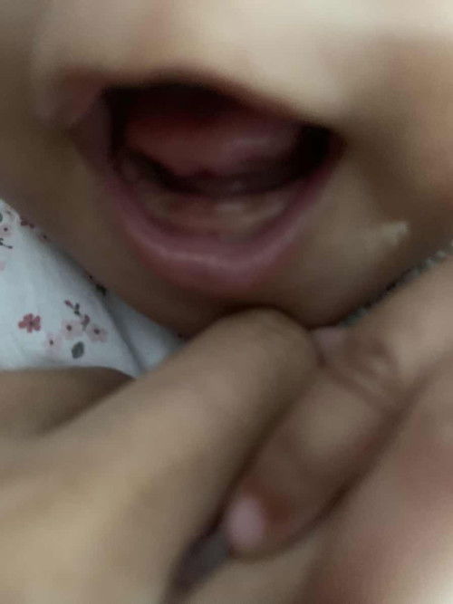 bayi usia 6bulan kurang beberapa hari