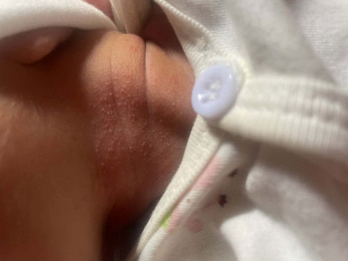 สอบถามแม่ๆค่ะ