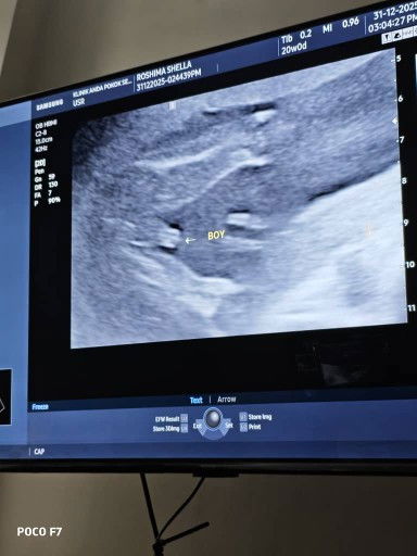 USG 20 weeks due may 2026