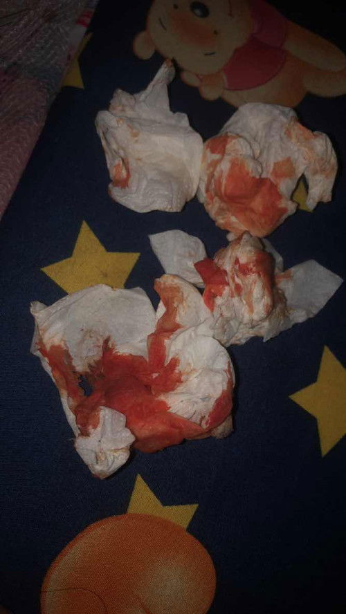 37+1 มีเลือดออกแบบนี้คืออะไรคะ