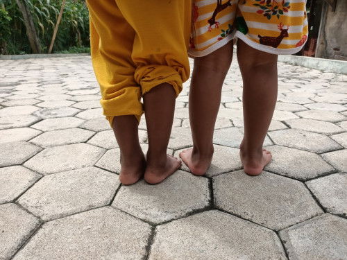 Tumit anak seperti miring