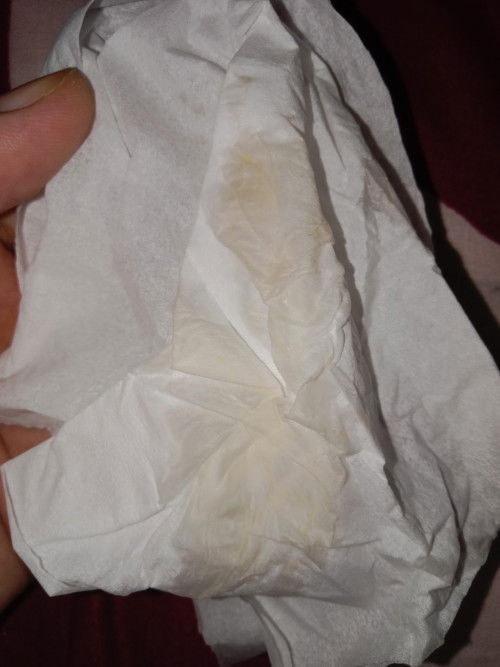 Keputihan pada uk 36/37 week