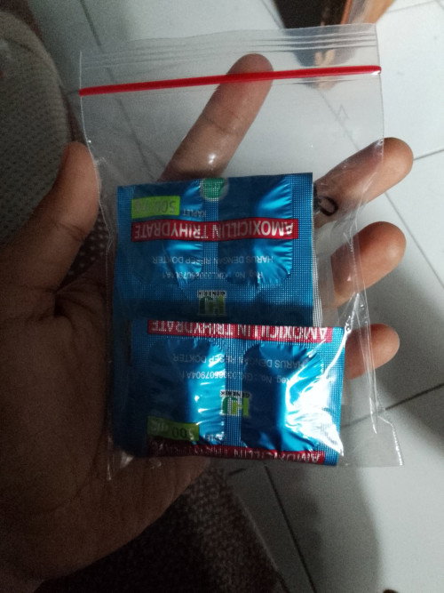 Radang tenggorokan sampai badan ngilu