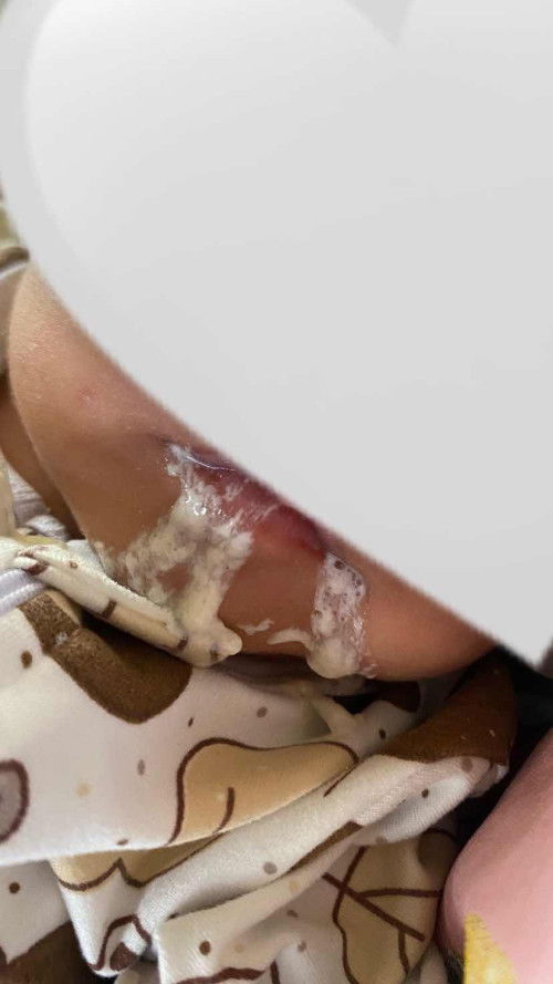 ปรึกษาแม่ๆหน่อยค่ะ