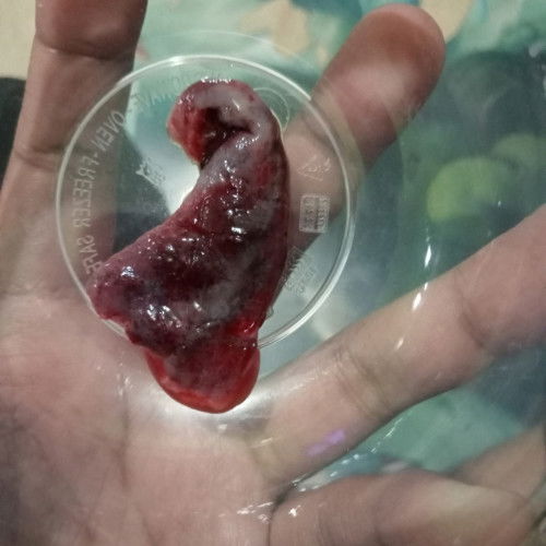 Keluar gumpalan putih