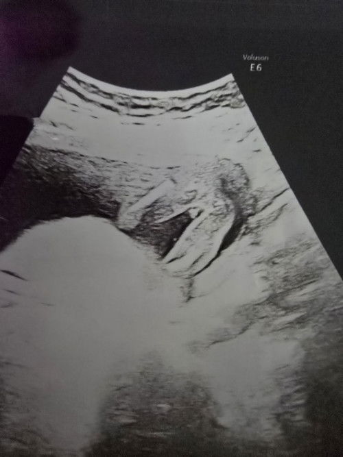 หญิงหรือชายค่ะ