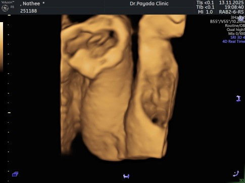 ผญ.หรือ ผช.คะ แม่ๆช่วยดูหน่อย😅