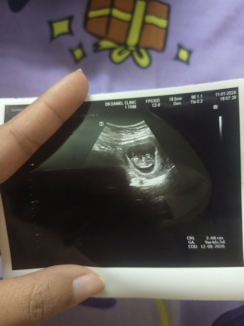 เด็กน้อย9week