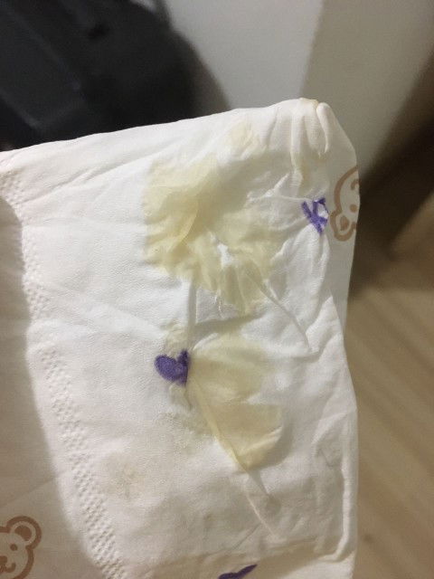 Keputihan normal ka?