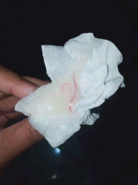 39week 1 hari, keluar lendir campur darah tadi pagi,kenceng sering TPI blm mules,HPL 26 januari