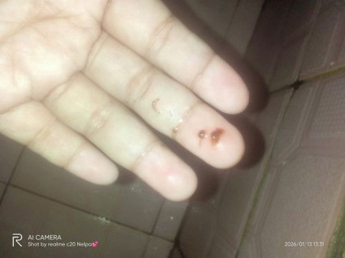 Keluar flek saat pipis