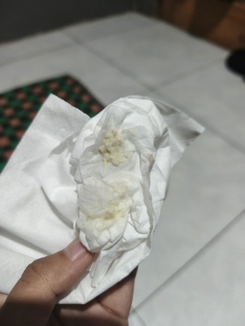 Keputihan dan ketuban rembes