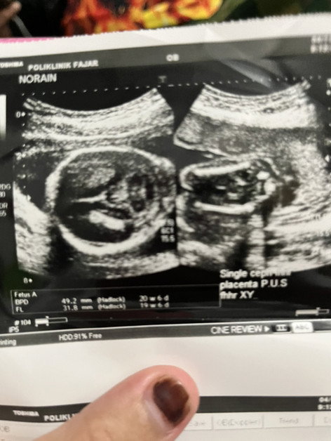 Post reply image