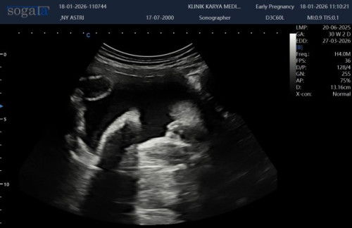 Di usg cewek berharap cowok😁