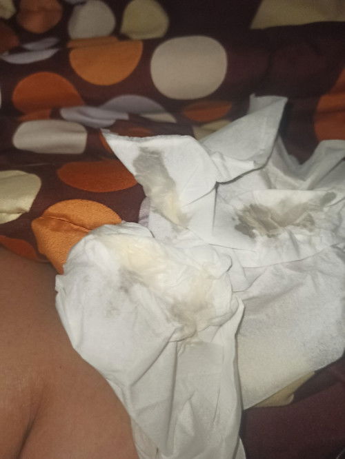 Keputihan sehabis hb