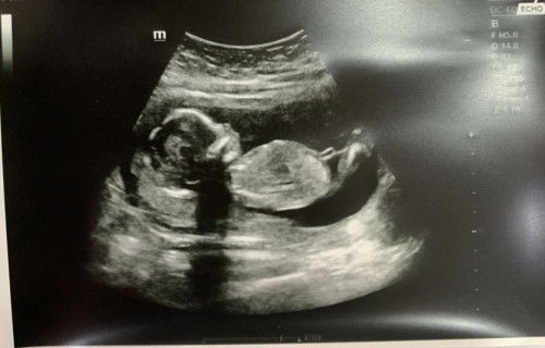 Ask ko lang po anong gender neto