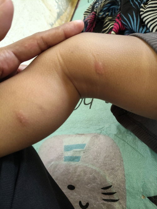 Kondisi Anak usia 14 bulan