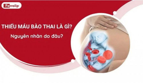 Thiếu máu bào thai là gì? Nguyên nhân gây thiếu máu bào thai