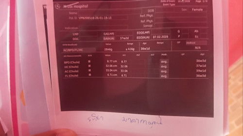 ดูใบซาวด์ให้หน่อยค่ะกำหนดคลอดวันไหน