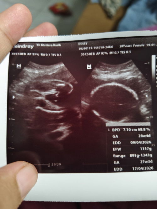 Usg 27minggu cewek lagi