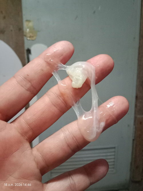 ตั้งครรภ์26+4 W