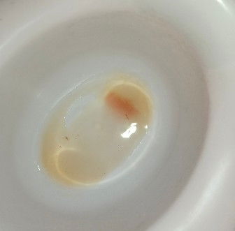 Balisawsaw ng buntis