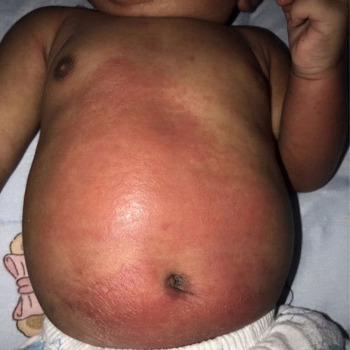 Bun ada yg tau Ini Knpa ya?