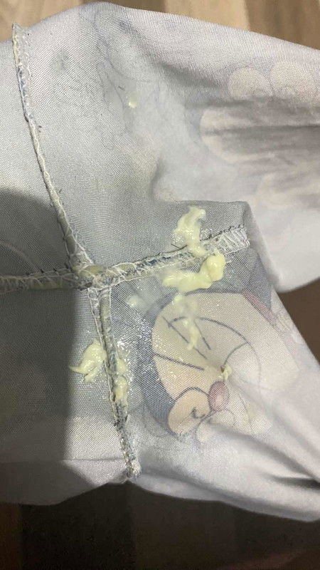 ตกขาวแบบนี้ปกติไหม