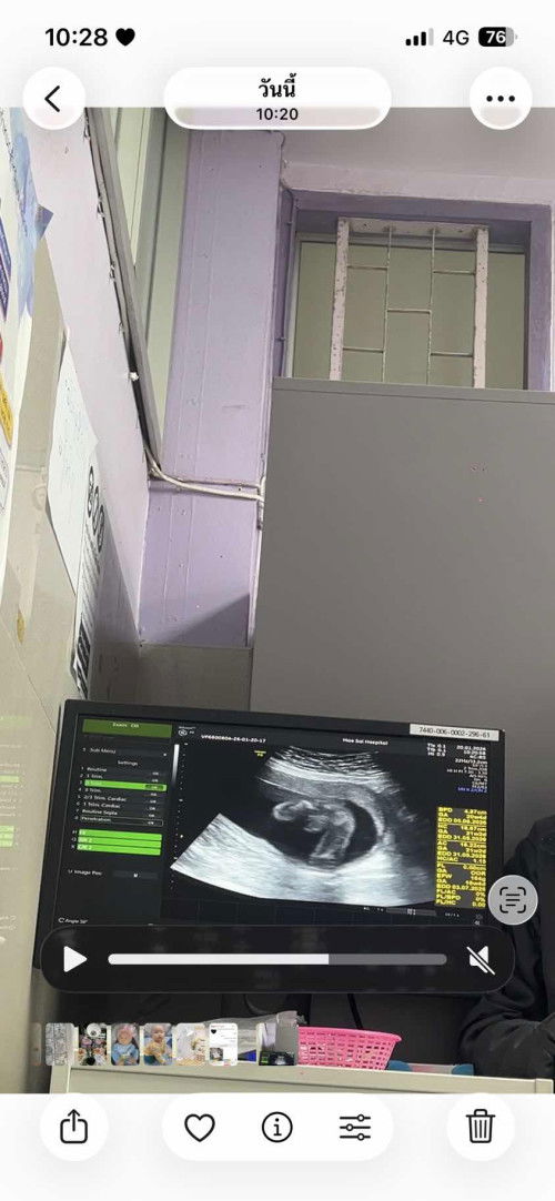 แม่ๆช่วยแชร์ประสบการหน่อยนะคะ อยากได้ลูกสาวค่ะ🥰