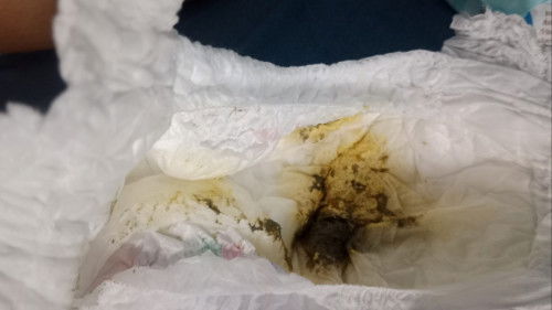 กินนมผงแบบนี้ปกติมั้ยคะ