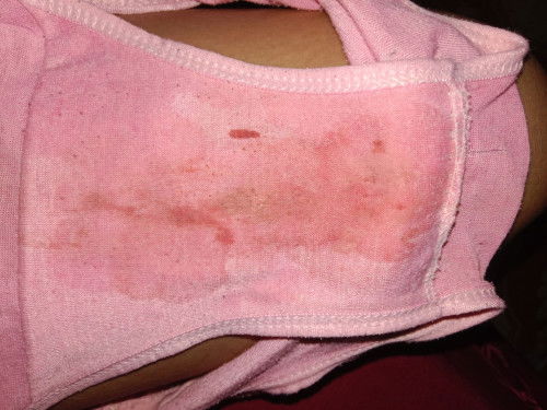 Hamil 37 week(maaf banget yaa fotonya agak jorok🙏🏽🙏🏽)