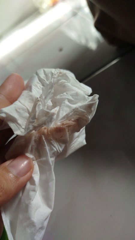 Ngeflek diminggu ke 6 kehamilan apakah bahaya?