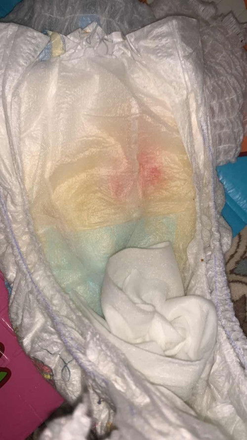 Darah ke ni? Apa punca nya?