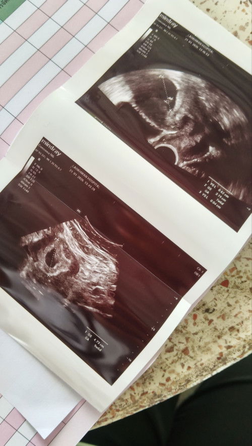 ท้อง 7 สัปดาห์