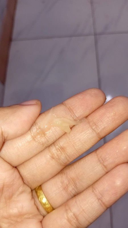 Bun mau tanya saya hamil 6 minggu klo keluar keputihan sprti ini normal gak sih